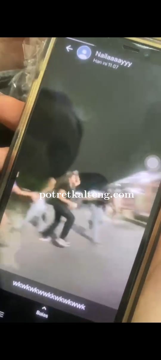 Gara Gara Baju, Gadis Ini Dipukul 2 Wanita Usai Hadiri Ulang Tahun