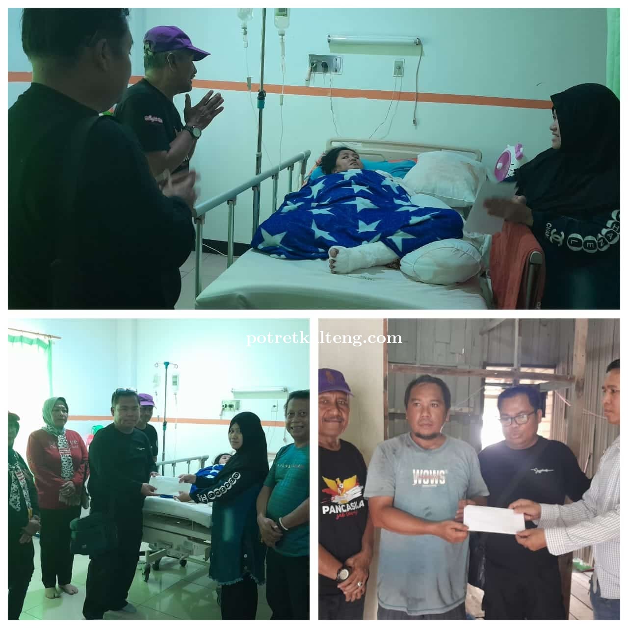 3 Korban Luka Bakar, Dapat Bantuan Dari Forum Kebangsaan Kalteng