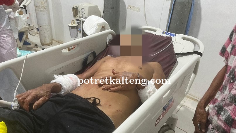Seorang Petani di Bataguh Jadi Korban Penganiayaan, Pelaku Gunakan Parang